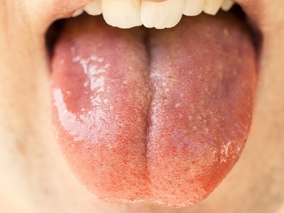 肌肽鋅應用於癌友口腔黏膜炎的幫助？