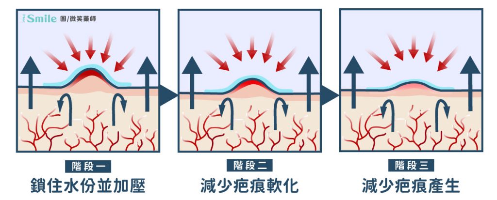 俊傑館-全齡養生宅 | 居家傷口照護要準備甚麼?藥局品項百百款~各種藥水優缺點一次看!